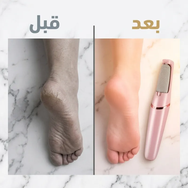 مقشر القدم الحديث القابل لاعادة الشحن