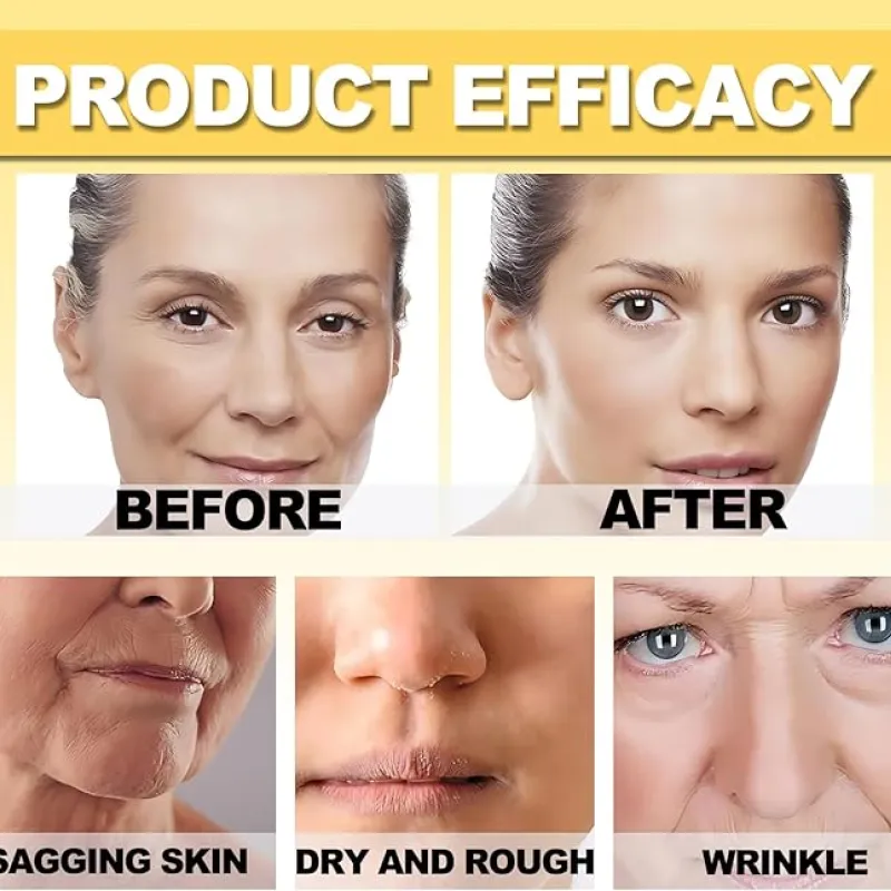 botox bee venom Cream عرض قطعتين